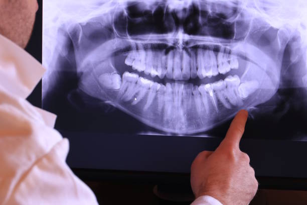 Best Emergency Wisdom Teeth Removal in Fountainhead Orchard Hills, MD