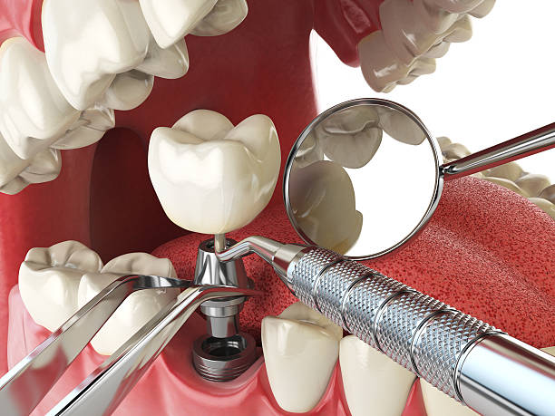 Reliable MD Emergency Dentist Solutions