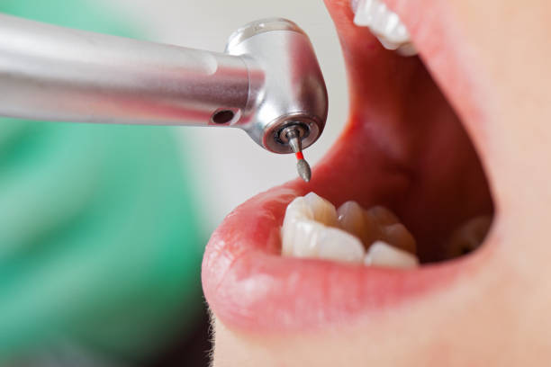 Best Emergency Dental Care for Trauma or Injury in Fountainhead Orchard Hills, MD